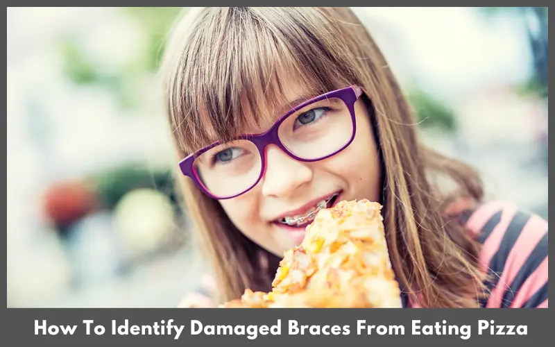 How To Identify Damaged Braces From Eating Pizza